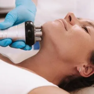 RADIOFRECUENCIA - 6 sesiones